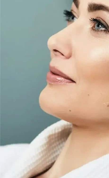 Inyección de Botox